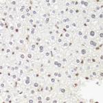 POLR2B Polyclonal Antibody