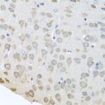 PABPC4 Antibody in Immunohistochemistry (Paraffin) (IHC (P))