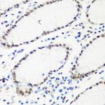 HTATSF1 Antibody in Immunohistochemistry (Paraffin) (IHC (P))
