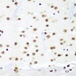 HTATSF1 Polyclonal Antibody