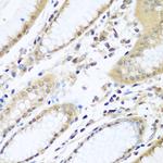 WDR48 Polyclonal Antibody