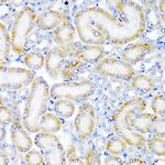 WRB Polyclonal Antibody