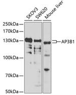 AP3B1 Polyclonal Antibody