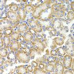 BMP-15 Antibody in Immunohistochemistry (Paraffin) (IHC (P))