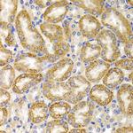 BMP-15 Polyclonal Antibody