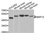 BMP-15 Antibody in Western Blot (WB)
