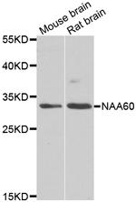 NAT15 Antibody in Western Blot (WB)