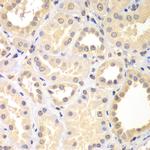 SPIN2 Antibody in Immunohistochemistry (Paraffin) (IHC (P))