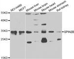 SPIN2 Antibody in Western Blot (WB)
