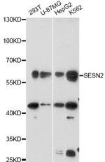 SESN2 Antibody in Western Blot (WB)