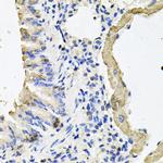 MYH7 Polyclonal Antibody