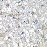 C1GALT1C1 Antibody in Immunohistochemistry (Paraffin) (IHC (P))