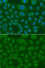 ANXA8L1 Antibody in Immunocytochemistry (ICC/IF)