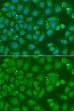 ANXA8L1 Polyclonal Antibody