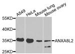 ANXA8L1 Antibody in Western Blot (WB)