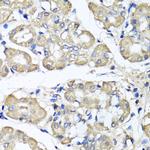 BCS1L Antibody in Immunohistochemistry (Paraffin) (IHC (P))