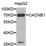 CACNB1 Polyclonal Antibody