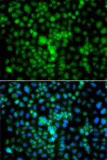 CIDEA Polyclonal Antibody