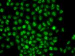 CIDEA Antibody in Immunocytochemistry (ICC/IF)