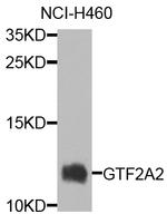 GTF2A2 Polyclonal Antibody