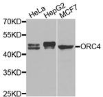 ORC4 Antibody in Western Blot (WB)
