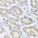 RCN2 Polyclonal Antibody