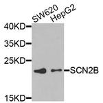 SCN2B Polyclonal Antibody