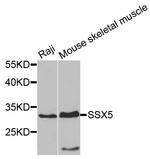 SSX5 Polyclonal Antibody