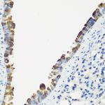 TNNC2 Antibody in Immunohistochemistry (Paraffin) (IHC (P))