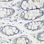 TNNC2 Polyclonal Antibody