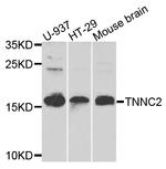 TNNC2 Antibody in Western Blot (WB)
