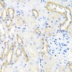 BSND Antibody in Immunohistochemistry (Paraffin) (IHC (P))