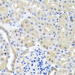 BSND Polyclonal Antibody