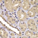 BAG2 Polyclonal Antibody