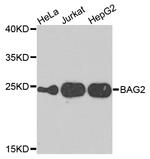 BAG2 Antibody in Western Blot (WB)