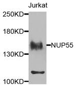 NUP155 Antibody in Western Blot (WB)