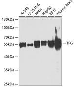 TRK fused gene Polyclonal Antibody