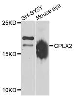 CPLX2 Polyclonal Antibody