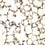 PHF11 Antibody in Immunohistochemistry (Paraffin) (IHC (P))