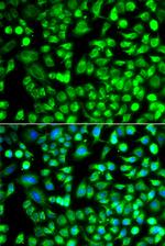 ALKBH4 Polyclonal Antibody