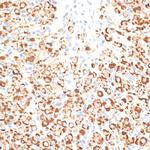 KLHL9 Antibody in Immunohistochemistry (Paraffin) (IHC (P))