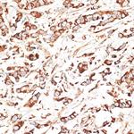 KLHL9 Polyclonal Antibody