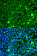 GBA3 Polyclonal Antibody