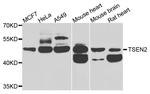TSEN2 Polyclonal Antibody