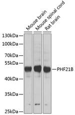PHF21B Polyclonal Antibody