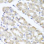 SPICE1 Polyclonal Antibody