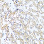 CHD1 Antibody in Immunohistochemistry (Paraffin) (IHC (P))