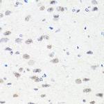 CHD1 Antibody in Immunohistochemistry (Paraffin) (IHC (P))