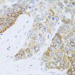 CHD1 Polyclonal Antibody