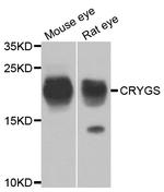 CRYGS Polyclonal Antibody